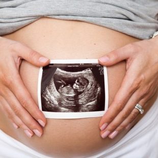 embarazada con radiografia en la barriga